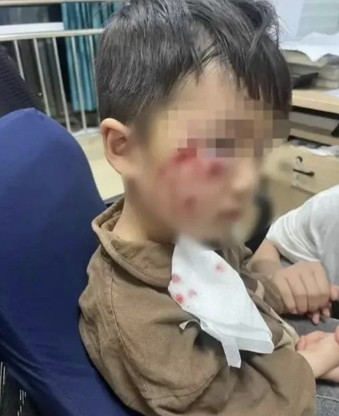 被瘋?cè)麤](méi)有“救命藥”，怎么辦？